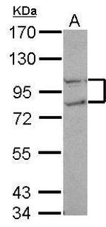 FCP1 Antibody in Western Blot (WB)