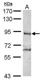 RNF10 Antibody in Western Blot (WB)
