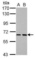 SH2D3A Antibody in Western Blot (WB)