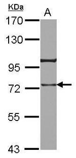 TRAP1 Antibody in Western Blot (WB)