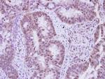 Vinexin Antibody in Immunohistochemistry (Paraffin) (IHC (P))