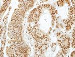 PHAPI2 Antibody in Immunohistochemistry (Paraffin) (IHC (P))