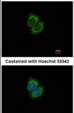 CaMKK beta Antibody in Immunocytochemistry (ICC/IF)