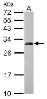 AP3M2 Antibody in Western Blot (WB)