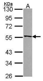 RbAp48 Antibody in Western Blot (WB)