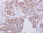 HSPE1 Antibody in Immunohistochemistry (Paraffin) (IHC (P))