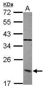 Dynactin 3 Antibody in Western Blot (WB)