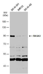 RASA3 Antibody in Western Blot (WB)