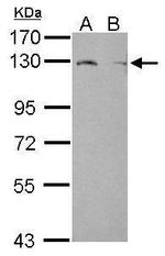 LPIN1 Antibody in Western Blot (WB)