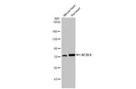 ACSL6 Antibody in Western Blot (WB)