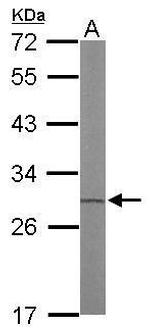 ETHE1 Antibody in Western Blot (WB)