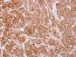 SH3BP1 Antibody in Immunohistochemistry (Paraffin) (IHC (P))