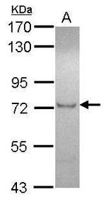 ZFP95 Antibody in Western Blot (WB)