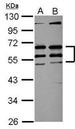 CREST Antibody in Western Blot (WB)