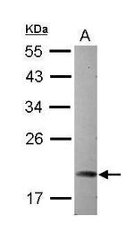 ARL5A Antibody in Western Blot (WB)