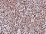 FBXL4 Antibody in Immunohistochemistry (Paraffin) (IHC (P))