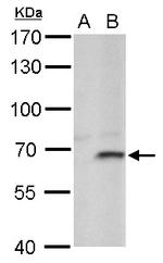 FBXL4 Antibody in Western Blot (WB)