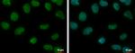 CREST Antibody in Immunocytochemistry (ICC/IF)