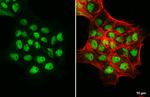 CREST Antibody in Immunocytochemistry (ICC/IF)