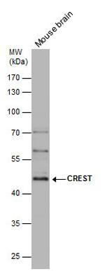 CREST Antibody in Western Blot (WB)