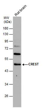 CREST Antibody in Western Blot (WB)