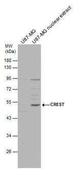 CREST Antibody in Western Blot (WB)