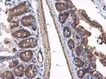 VPS36 Antibody in Immunohistochemistry (Paraffin) (IHC (P))