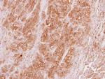 VPS36 Antibody in Immunohistochemistry (Paraffin) (IHC (P))