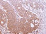 TRIM17 Antibody in Immunohistochemistry (Paraffin) (IHC (P))