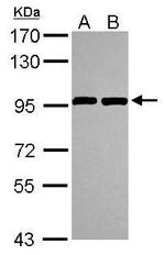 ANKZF1 Antibody in Western Blot (WB)