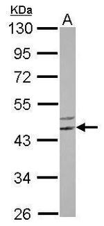 SGK494 Antibody in Western Blot (WB)