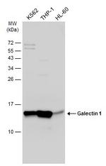 Galectin 1 Antibody in Western Blot (WB)