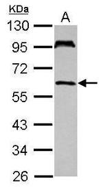 UBASH3A Antibody in Western Blot (WB)