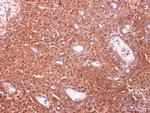 TOMM34 Antibody in Immunohistochemistry (Paraffin) (IHC (P))