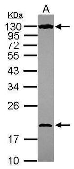 NOL6 Antibody in Western Blot (WB)