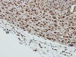 SMC6 Antibody in Immunohistochemistry (Paraffin) (IHC (P))