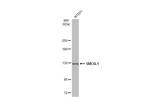 SMC6 Antibody in Western Blot (WB)