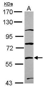 ZNF671 Antibody in Western Blot (WB)