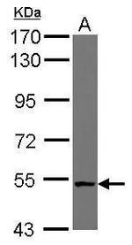 CML66 Antibody in Western Blot (WB)