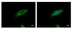 HIP1R Antibody in Immunocytochemistry (ICC/IF)