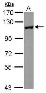 HIP1R Antibody in Western Blot (WB)