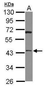 HTRA3 Antibody in Western Blot (WB)