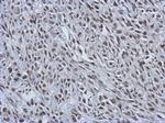 RALY Antibody in Immunohistochemistry (Paraffin) (IHC (P))