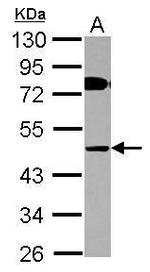 COLQ Antibody in Western Blot (WB)