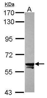 TOE1 Antibody in Western Blot (WB)