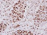 hnRNP A2B1 Antibody in Immunohistochemistry (Paraffin) (IHC (P))