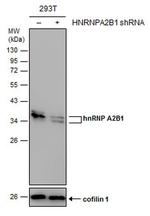 hnRNP A2B1 Antibody