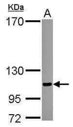 SENP5 Antibody in Western Blot (WB)