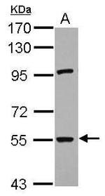 RNF168 Antibody in Western Blot (WB)