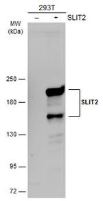 SLIT2 Antibody in Western Blot (WB)